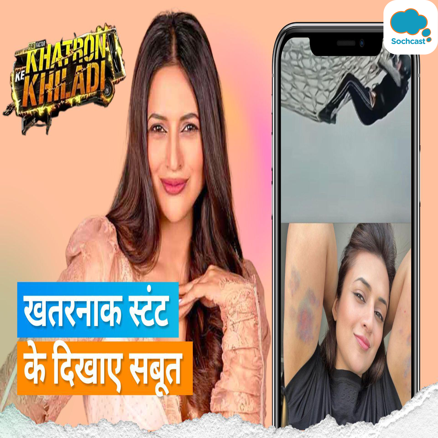 Divyanka Tripathi: धाकड़ गर्ल ने दिखाए चोट के निशान, टीवी एक्ट्रेस ने शेयर की फोटो